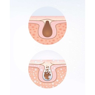 Ansiktssauna Facial Care Lanaform